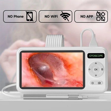 Otoscope Camera Ear Picker Waxing Carousel 1