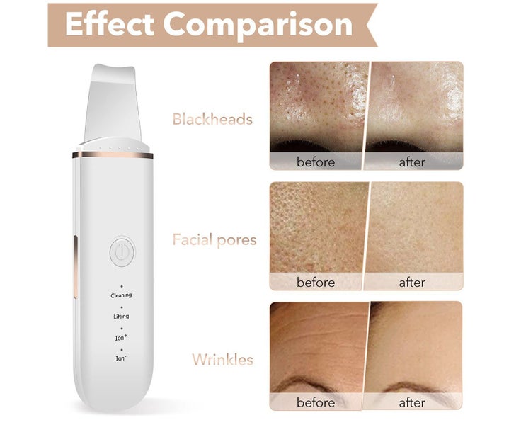 Skin Scrubber Face Skin Spatula Blackhead Remover Pore Cleaner Face Beauty Li Carousel 5