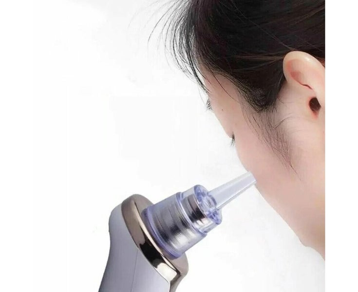 Face Facial Pore Blackhead Remover Vacuum Suction Diamond Pimple Cleaner Ma Carousel 8