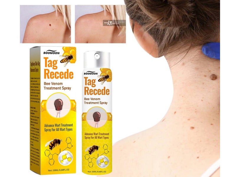 Bee Venom Mole Wart Remover Sale Sale Sale Carousel 2