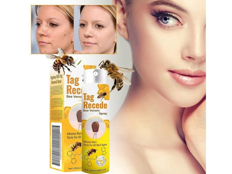 Bee Venom Mole Wart Remover Sale Sale Sale Carousel 1