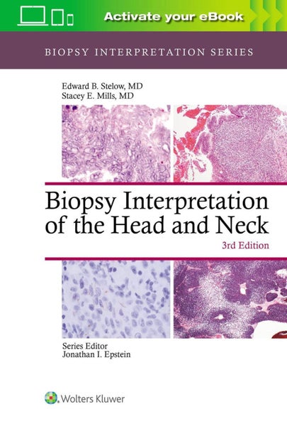 Biopsy Interpretation of the Head and Neck by Edward B. Stelow - Hardcover Carousel 1