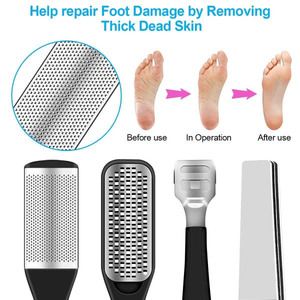 NEW Foot File Pedicure Kit on Afterpay Carousel 2