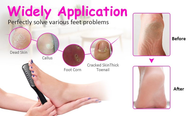 NEW Foot File Pedicure Kit on Afterpay Carousel 10