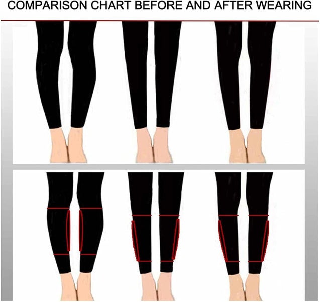 Calf Pads - Anti Allergic Soft Silicone Calf Corrector Women Leg Gel Corrector Carousel 2