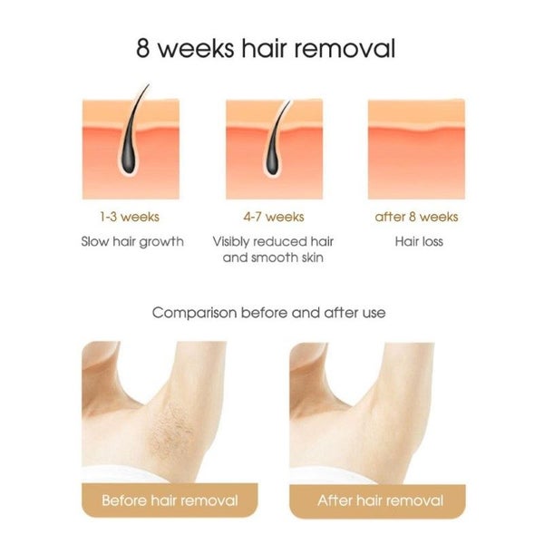 Laser Hair remover Sale Sale Carousel 2
