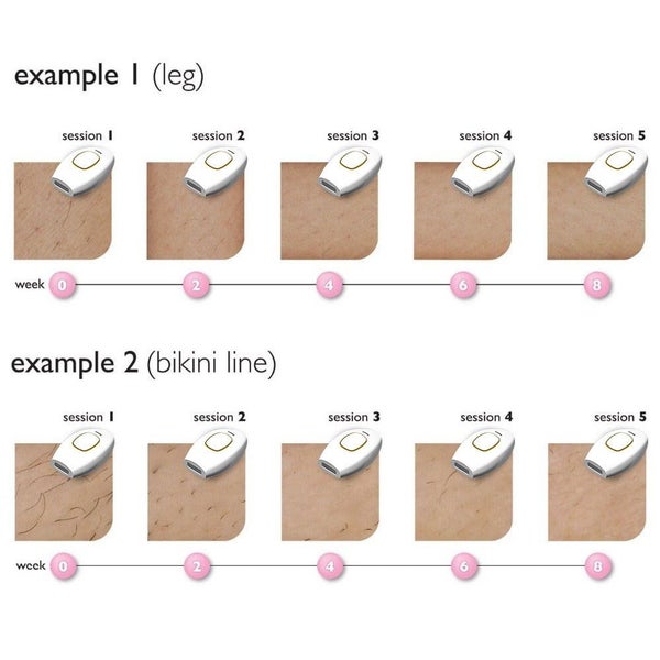 Laser Hair remover Sale Sale Carousel 11