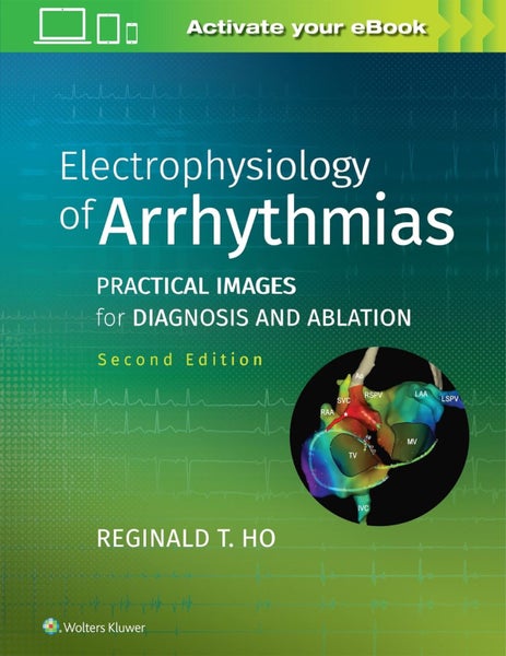 Electrophysiology of Arrhythmias by Reginald T. Ho - Hardcover Carousel 1