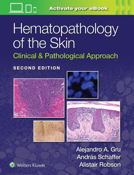 Hematopathology of the Skin by Alejandro Ariel Gru - Hardcover Carousel 1