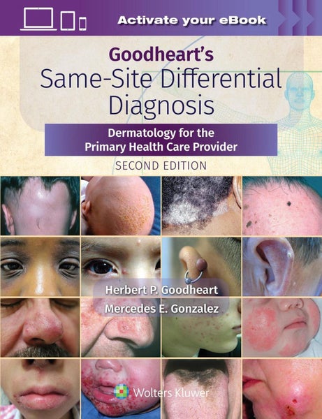 Goodheart's Same-Site Differential Diagnosis by Herbert Goodheart - Hardcover Carousel 1