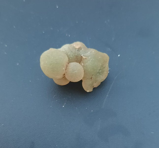 $1res- botroydial chalcedony -thumbnail specimen Carousel 1