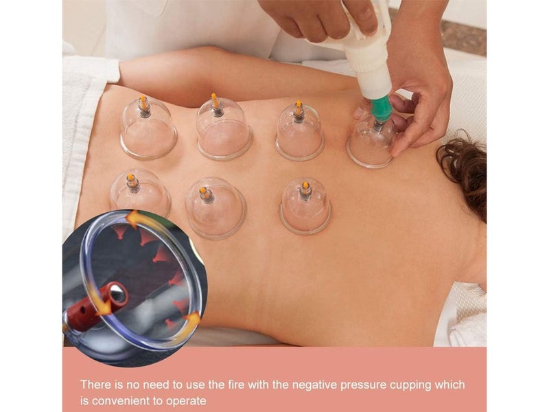 Cupping Set 24pcs NZ Clearance Carousel 2