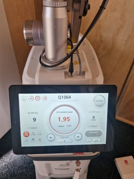 CuRas Advanced Q switch Nd YAG laser64414215940739112