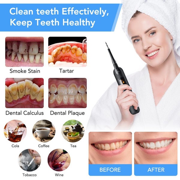 New Cordless Tooth Cleaner Plaque Remover62952856073089111