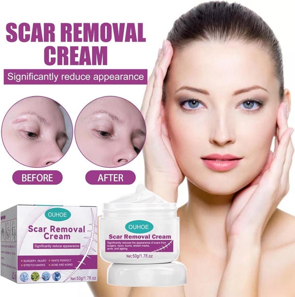 Stretch Mark Surgery Injury Acne Scar Removal Cream Carousel 1