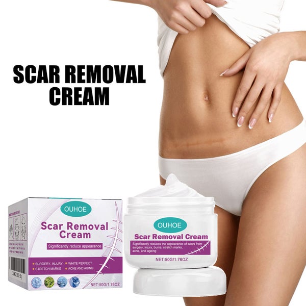 Stretch Mark Surgery Injury Acne Scar Removal Cream Carousel 2