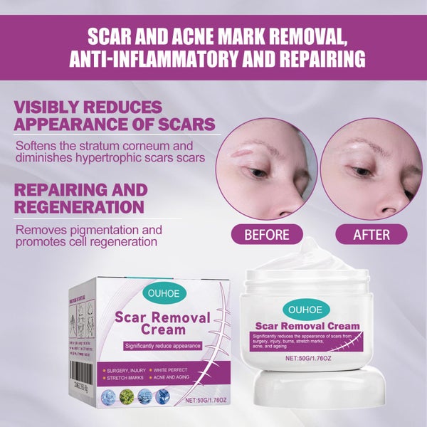Stretch Mark Surgery Injury Acne Scar Removal Cream Carousel 10