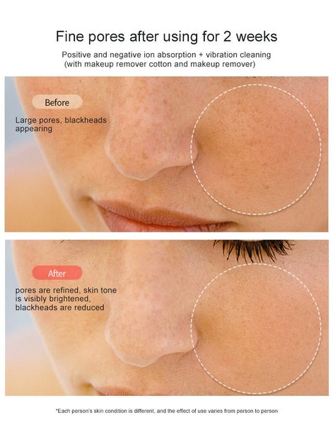 Radio Frequency Facial Machine, Anti-Aging Skin Tightening Skin Care Eqipment Carousel 5