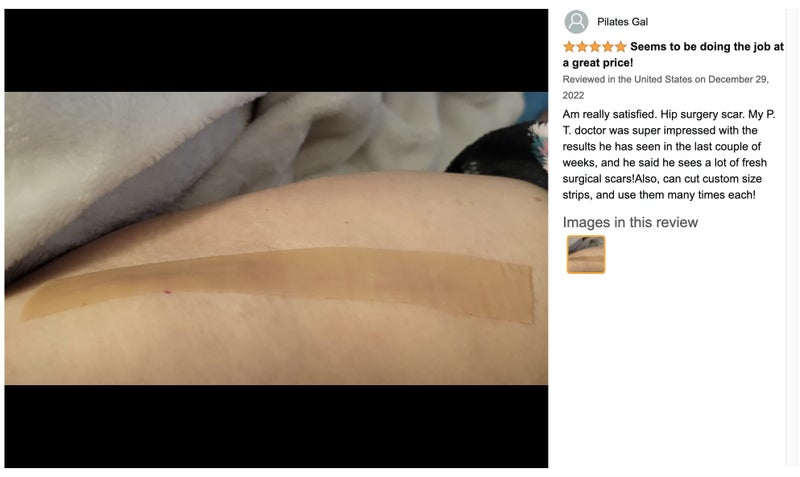 Silicone Scar Sheets, Silicone Scar Tape 4cm x 1.5m64192830484097112