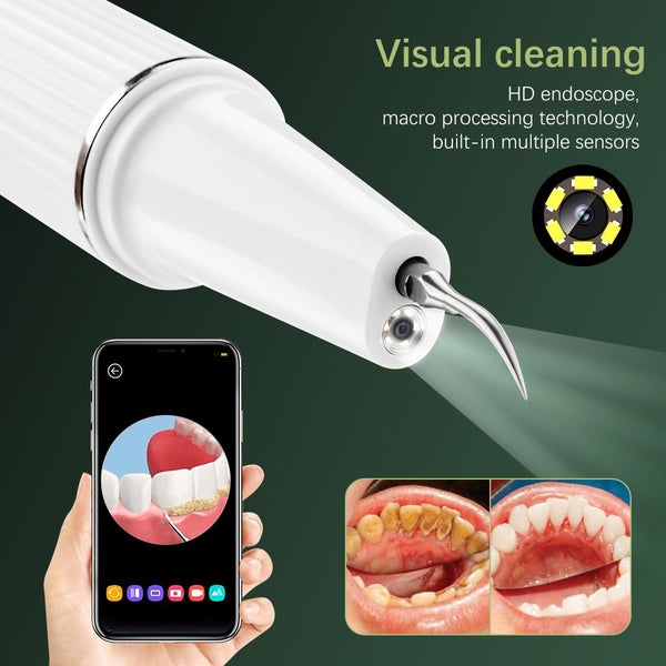 Electric Dental Calculus Remover Brand New62950956027266113