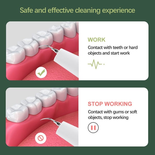 NEW Ultrasonic Electric Tooth Cleaner Sale Sale62960722934915112