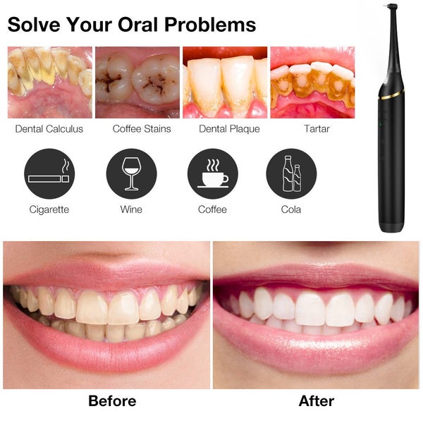 New Cordless Tooth Cleaner Plaque Remover63725664777473111