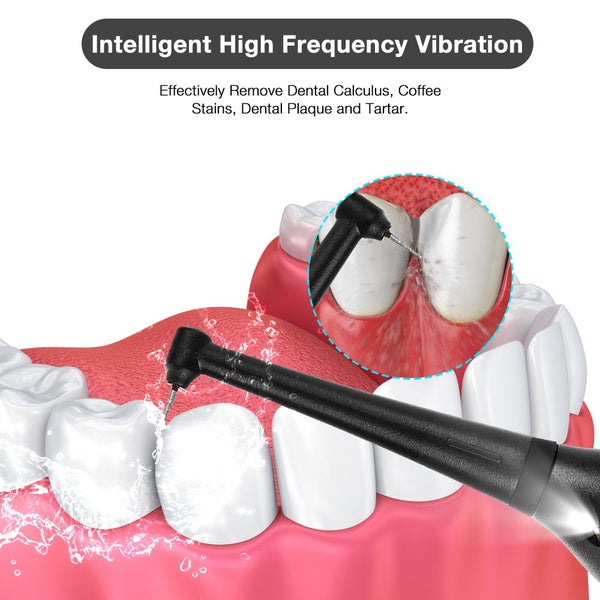 New Cordless Tooth Cleaner Plaque Remover63725664777473113