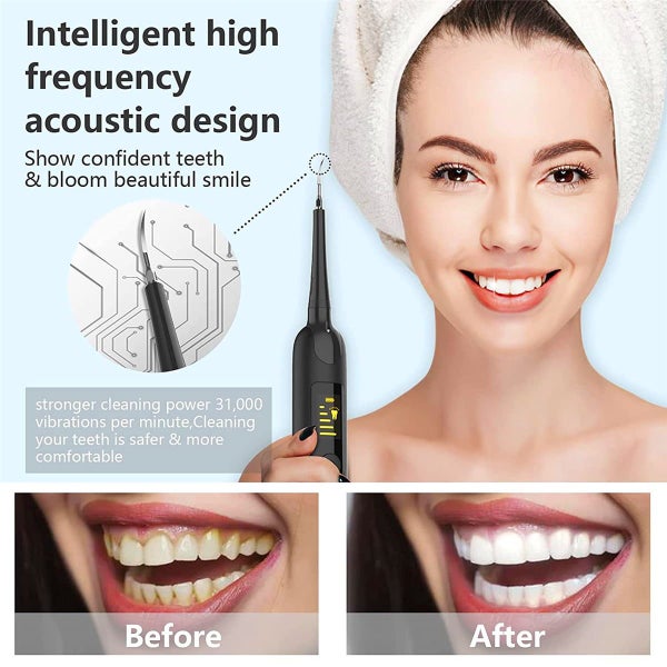 New Ultrasonic Electric Tooth Cleaner63803442665089111