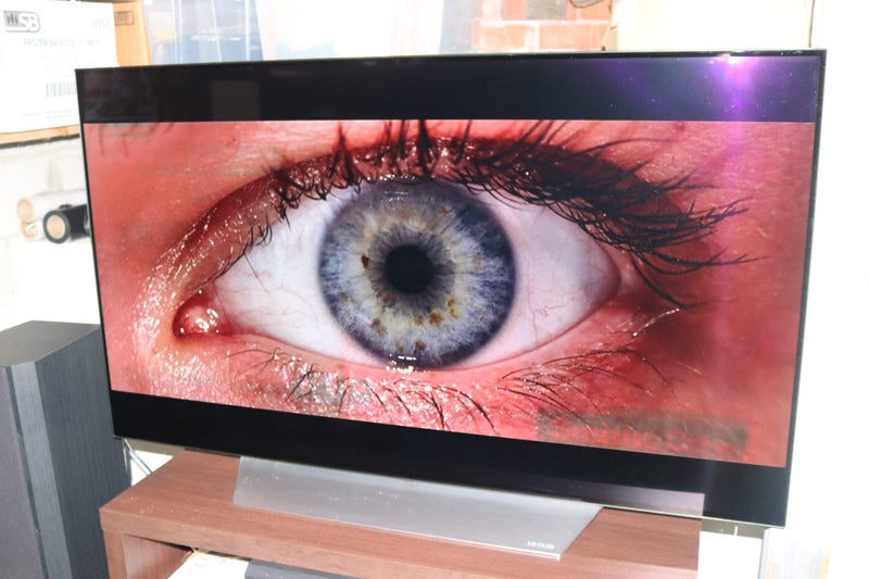 LG OLED TV - Burnt Screen Carousel 1