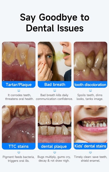 New Cordless Tooth Cleaner Plaque Remover Sale Sale62948102027906113