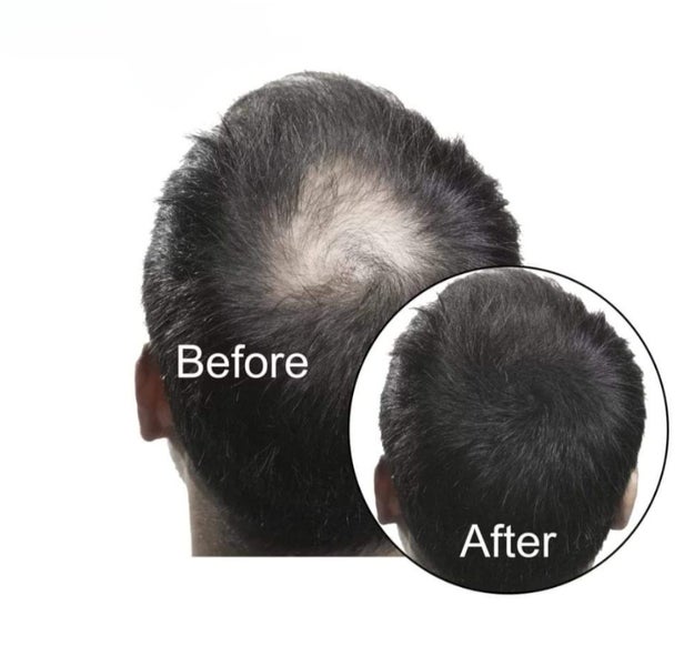 Sevich Hair Fiber + Hold Spray - BLACK Carousel 1