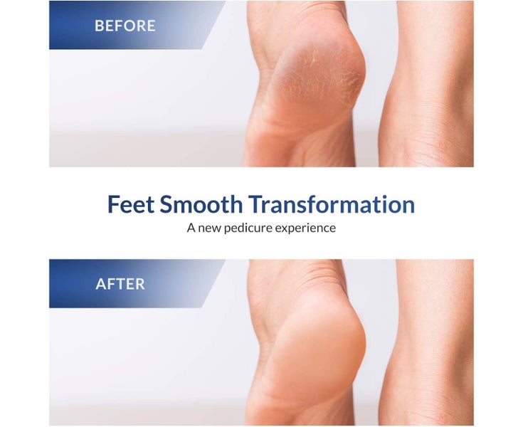 Foot Care Pedicure Stainless Steel File to Removes Hard Skin, Used On Both Dr Carousel 1