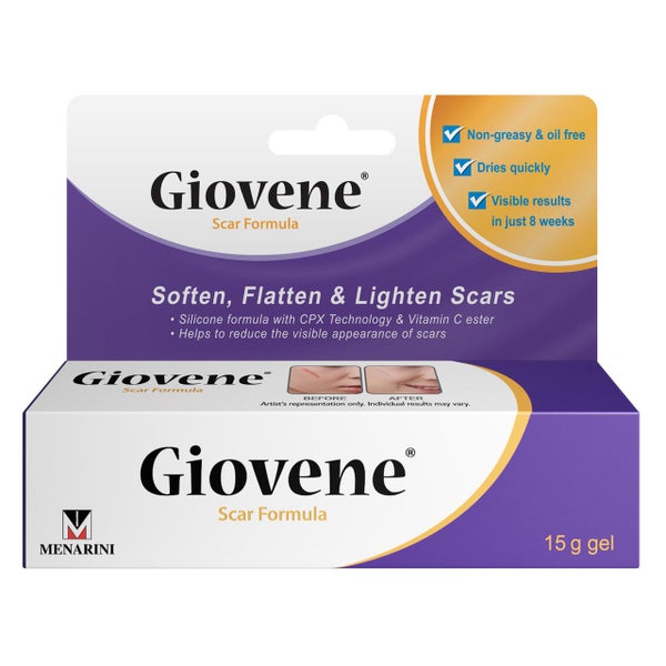 Giovene Specialised Scar Formula 15g Gel Carousel 4