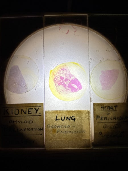 3 x old glass medical slides Carousel 1