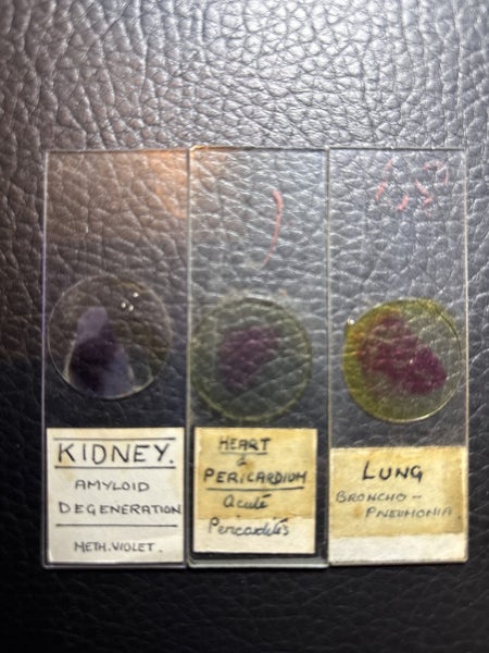 3 x old glass medical slides Carousel 2