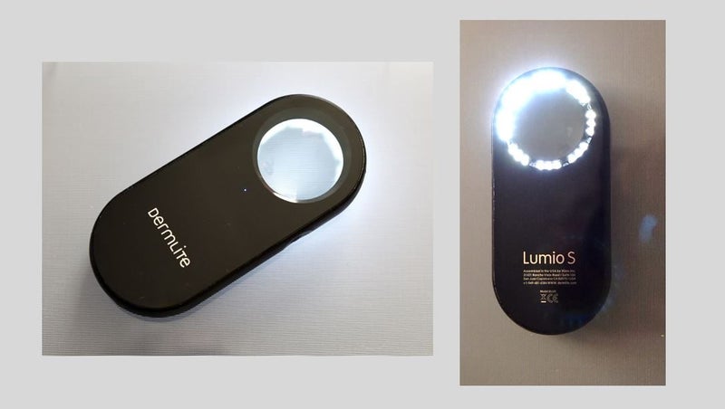 Dermlite Lumio S for dermatoscopic skin checks Carousel 1