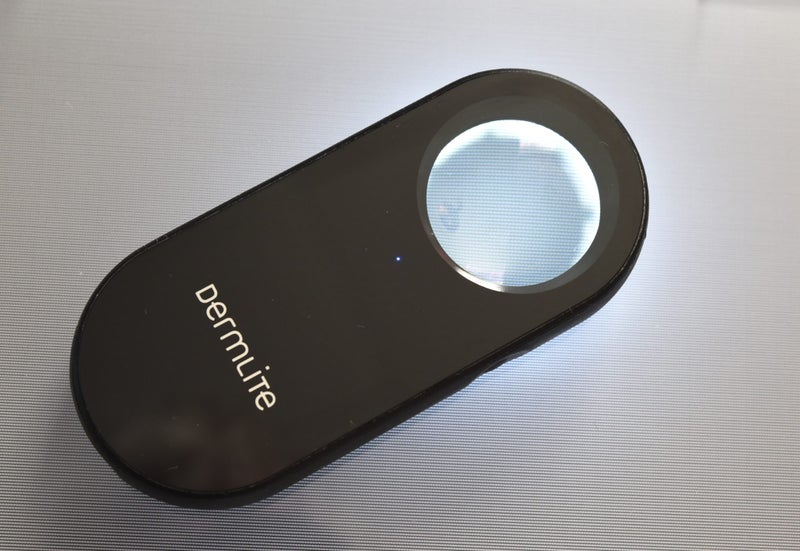 Dermlite Lumio S for dermatoscopic skin checks Carousel 2