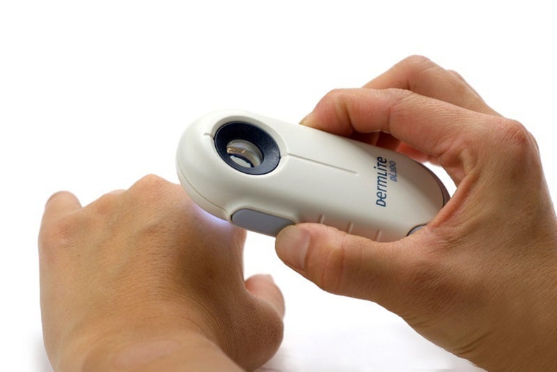Brand New Dermlite DL100 Dermatoscope - Under Half price Carousel 1