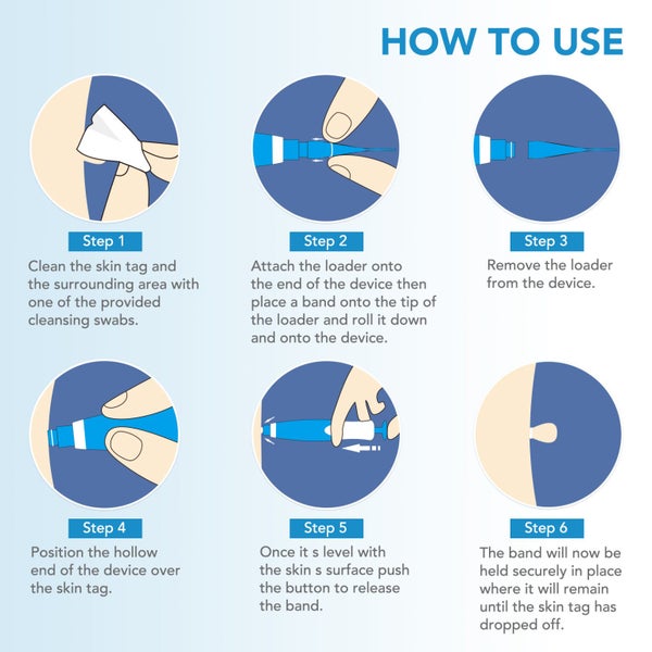 Auto Skin Tag Removal Kit Carousel 2