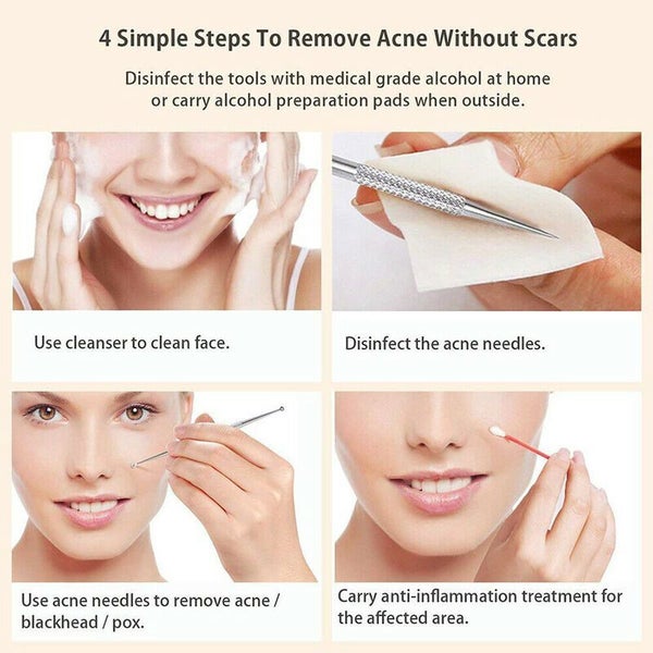 Acne Needle Blackhead Blemish Pimple Extractor Remover Carousel 11