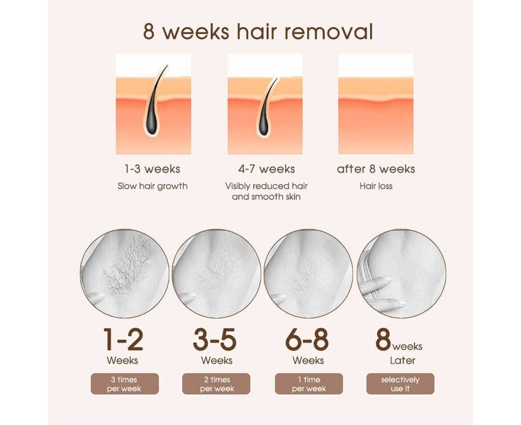 IPL Laser Facial Whole Body Laser Permanent Hair Removal Handset Device Carousel 8