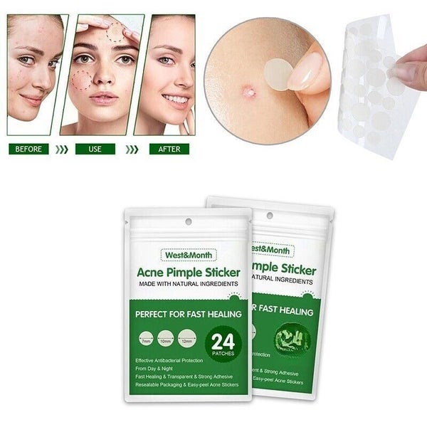 24pcs Skin Tag Remover Acne Pimple Patch Removal Facial Care Spot Plaster Carousel 2