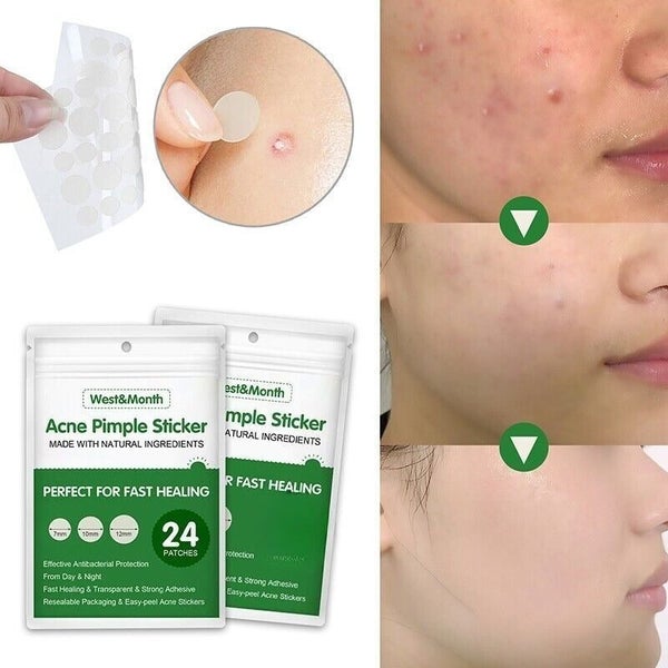 24pcs Skin Tag Remover Acne Pimple Patch Removal Facial Care Spot Plaster Carousel 6