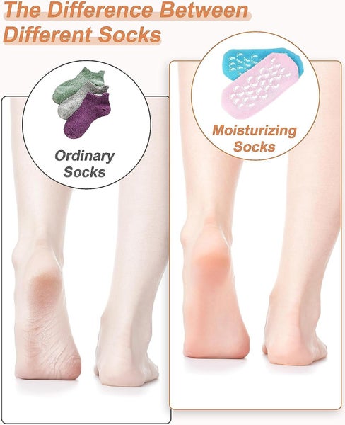 Moisturizing Socks Women 2 Pairs Dry Cracked Feet Lotion Socks Foot Moisturiz Carousel 5