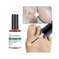 3X Corn Removal Extra Strengthen Gel Foot Callus Removal Treatment Hard Skin