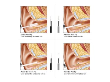 Listing 9 of 9 for Ear Cleaner Camera Local NZ Clearance