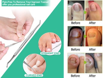 Listing 4 of 8 for Nail Clippers Set