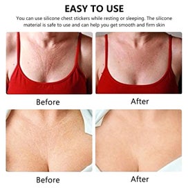 Listing 5 of 9 for 18Pcs Reusable Silicone Wrinkle Removal Stickers Anti-wrinkle Face Neck