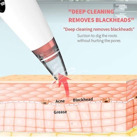 Listing 4 of 5 for Blackhead Remover Vacuum, Electric Pore Vacuum Blackhead Extractor Removal Tool