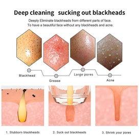 Listing 5 of 5 for Pore Vacuum With Camera, 20x Visible Blackhead Remover Wifi Wireless Connect Rea